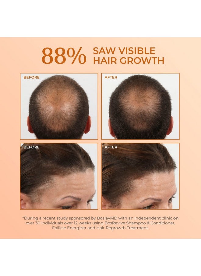 BOSLEYMD Bosrevive Volumizing Conditioner For Noticeably Thinning And Color/Chemicallytreated Hair 10.1 Fl Oz.  - Image 3