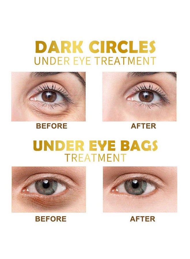 Felico Under Eye Patches 30 Pairs Gold Eye Mask Eye Gel Pads With Collagen Treatment For Reducing Dark Circles Lighten Wrinkles Antiaging Moisturizing Fine Lines Eye Bags Puffiness For Women Men - Image 4