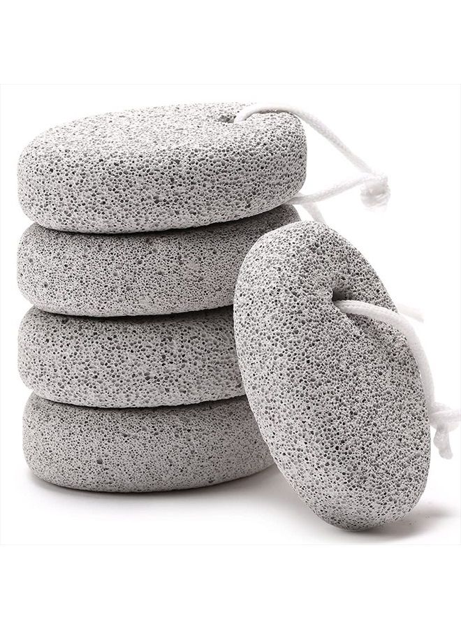Borogo Natural Foot Pumice Stone for Feet, Borogo 5-Pack Lava Pedicure Tools Hard Skin Callus Remover for Feet and Hands - Natural Foot File Exfoliation to Remove Dead Skin, Heels, Elbows, Hands - Image 1