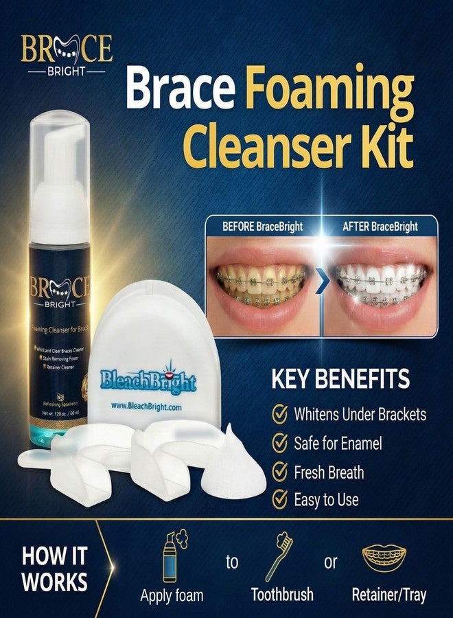 Foam Bright Teeth Whitening for Braces, Braces Cleaner Foam, Brace Teeth Whitening kit for Under Metal, Ceramic, Brackets & Wires. Cleaning Kit, Use w/Toothbrush or Trays No Sensitivity. Minty, Teens, Adults - Image 2