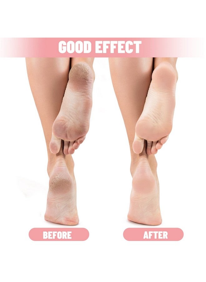 Tarpop Tarpop 3 Pairs Aloe Socks Moisturizing Spa Socks for Dry Cracked Feet Infused Socks Gel Sleeping Fuzzy Socks Lotion Socks Gift for Christmas Women Men Softening Dry Feet (Pink) - Image 4