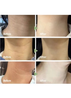 lakerain 50ml Tighten Lift Neck Cream with Hyaluronic Acid and Caffeine Anti Aging Neck Cream for Tightening Firming Smooth Fine Lines and Wrinkles Moisturizing Nourishing Neck Firming Cream Tighten Skin and Neck Lift Cream  - Image 4