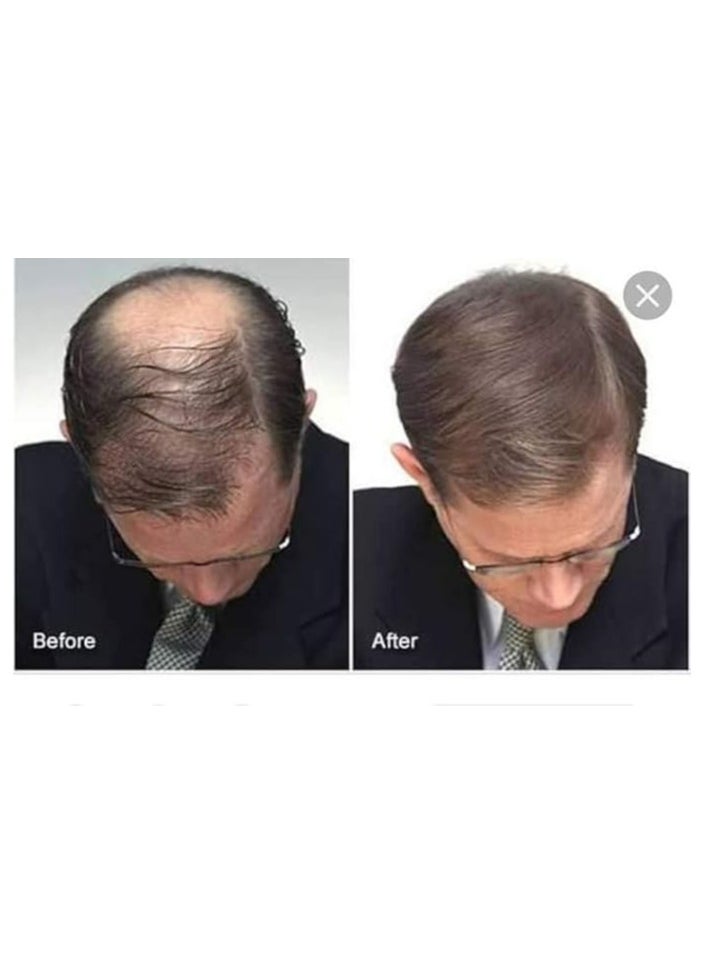 Faster Hair Back Garlic Advance  - Image 2