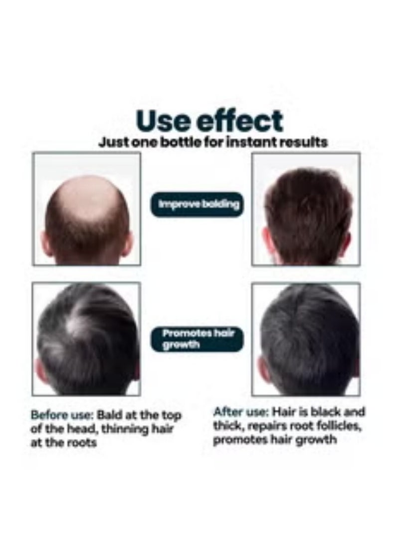 Kirkland Kirkland Signature Minoxidil for Men Extra Strength Hair Regrowth(1 Month Supply)  - Image 4