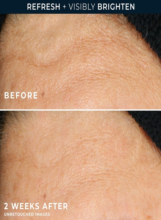 RoC Multi Correxion Revive + Glow Gel Facial Cleanser With Vitamin C, & Glycolic Acid, Paraben-Free, Sulfate-Free Skin Care, 6 Ounces - Image 5