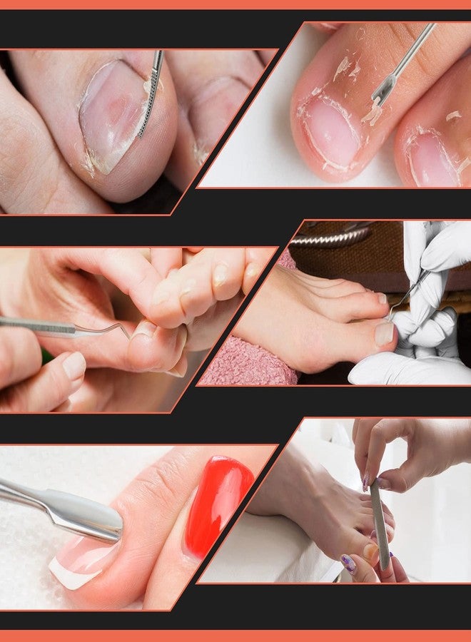 BEZOX Ingrown Toenail Removal Kit - Toenail Lifter and Thick Toenails File, Stainless Steel Pedicure Tools - 6PCS Nail Correction Set - Image 5