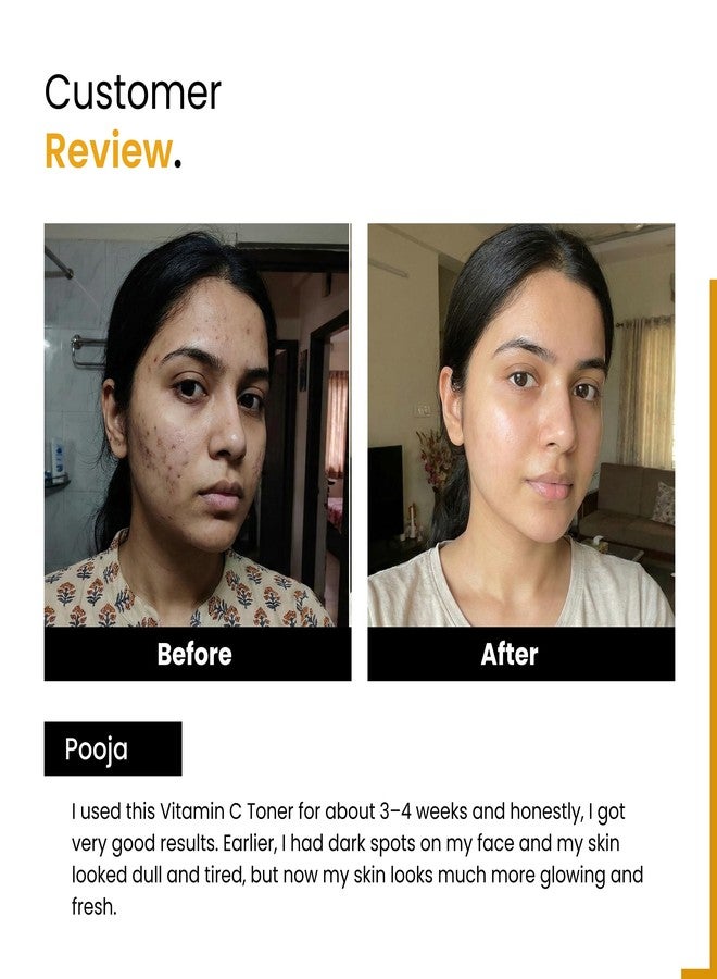 Ayumcure Vitamin C 1% Toner with 3% Niacinamide & Mandarin | Skin Brightening, Pore Tightening & Hydrating Face Toner | With Kakadu Plum | For All Skin Types | 200ml | For Men & Women - Image 5