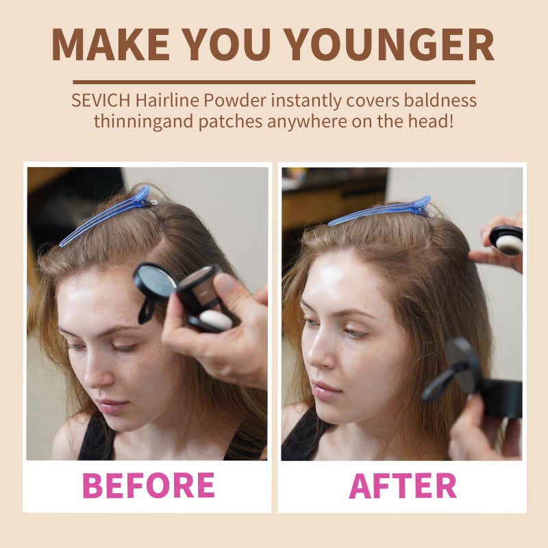 Sevich Hairline Powder,Instantly Conceals Hair Loss, Root Touch up Powder, Hair Shadow Toppers for Women & Men, Touch Up for Thinning Gray Hair, Windproof & Sweatproof,Black - Image 2