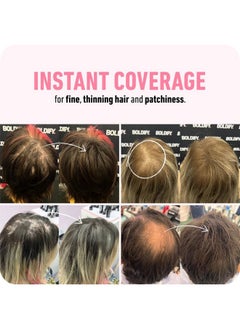 Boldify BOLDIFY Hair Fibers (28g) Fill In Fine and Thinning Hair for an Instantly Thicker & Fuller Look - Best Value & Superior Formula -14 Shades for Women & Men - WHITE  - Image 3