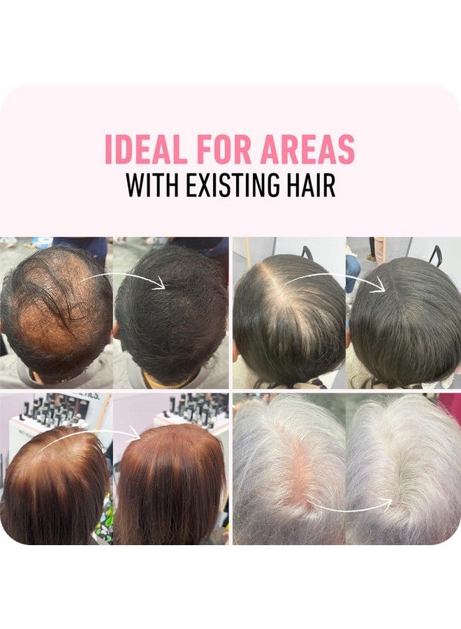 BOLDIFY Hair Fibers (28g) Fill In Fine and Thinning Hair for an Instantly Thicker & Fuller Look - Best Value & Superior Formula -14 Shades for Women & Men - WHITE - Image 4