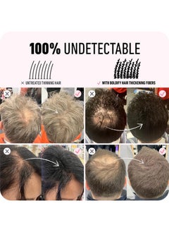 Boldify BOLDIFY Hair Fibers (28g) Fill In Fine and Thinning Hair for an Instantly Thicker & Fuller Look - Best Value & Superior Formula -14 Shades for Women & Men - WHITE  - Image 5