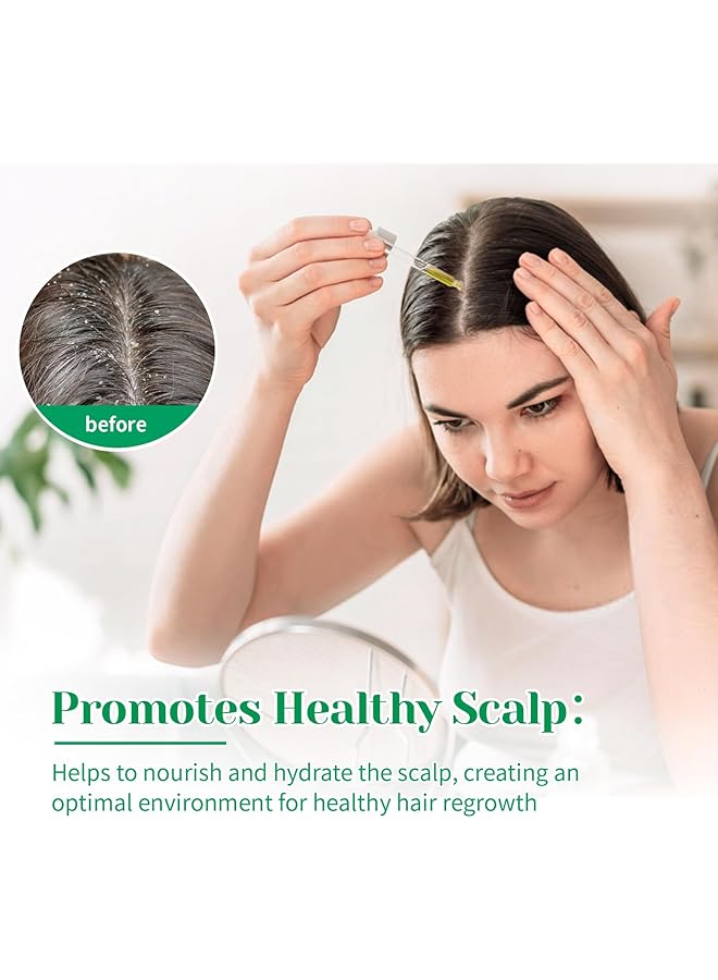 erorex 4 Fl Oz Rosemary Essential Oil Pure Rosemary Oil For Hair Growth Nourish Scalp And Skin Care 118Ml - Image 2