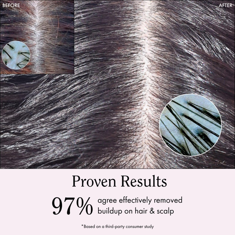 Rizos Curls غسول فروة الرأس والشعر من ريزوس كيرلز بنكهة خل التفاح للسفر، ينظف لإزالة تراكم المنتجات، يوازن الزيوت، ينعش الشعر وفروة الرأس، يعزز النعومة واللمعان، 2.5 أونصة - Image 4