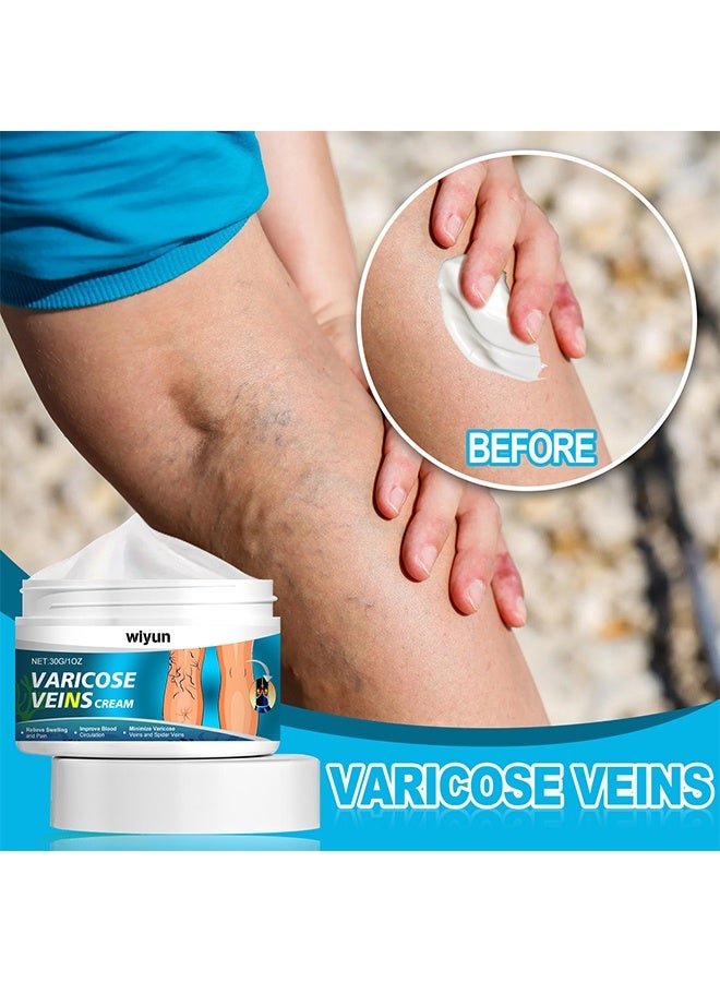 WIYUN Varicose Veins Cream, Soothing Leg Cream, Varicose And Spider Veins Treatment Cream, Improve Blood Circulation, Fast Relieve Swelling Pain, Soothe Tired Legs and Reduce Heaviness, 30G - Image 5