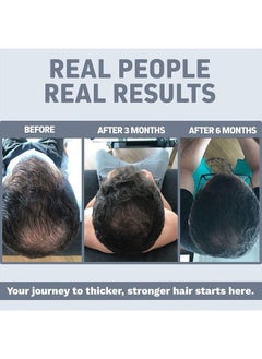 Herbtonics Foli-Tonic DHT Blocker & Hair Loss Supplement | Hair Thinning Treatment & Promotes Healthy Thicker Hair Growth (60 Count (Pack of 1))  - Image 2