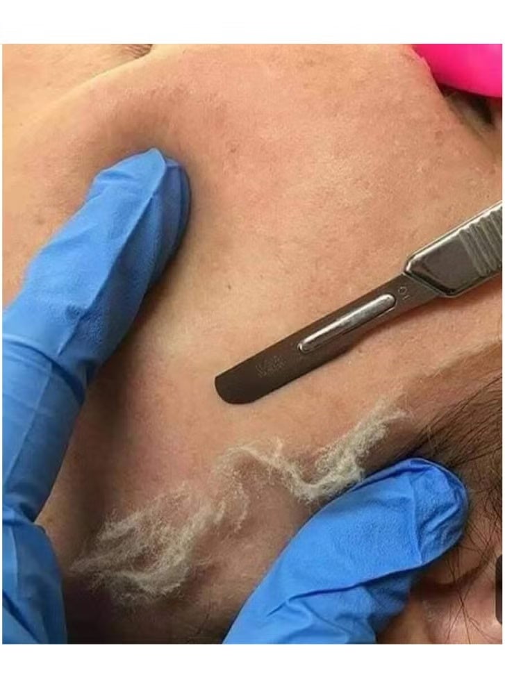 ديرما بلانينج مع 6 شفرات لازاله الشعر الوبرى لتقشير الجلد الميت - Image 3