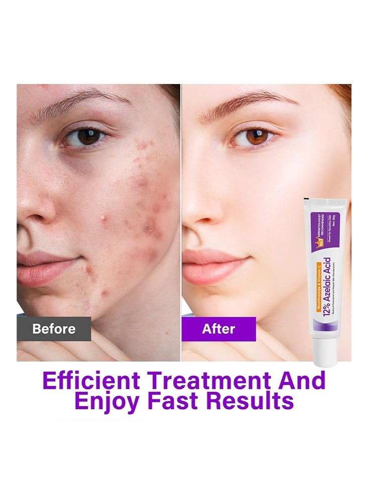 YOOJ 12% Azelaic Acid Serum- with Nicotinamide & Vitamin C, Against Redness, Anti Pimples and Nodules,Blemished Skin Face and Pore Cleansing, Great for Sensitive Skin 20g - Image 2