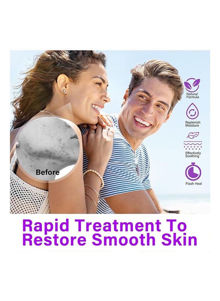 YOOJ 12% Azelaic Acid Serum- with Nicotinamide & Vitamin C, Against Redness, Anti Pimples and Nodules,Blemished Skin Face and Pore Cleansing, Great for Sensitive Skin 20g - Image 5