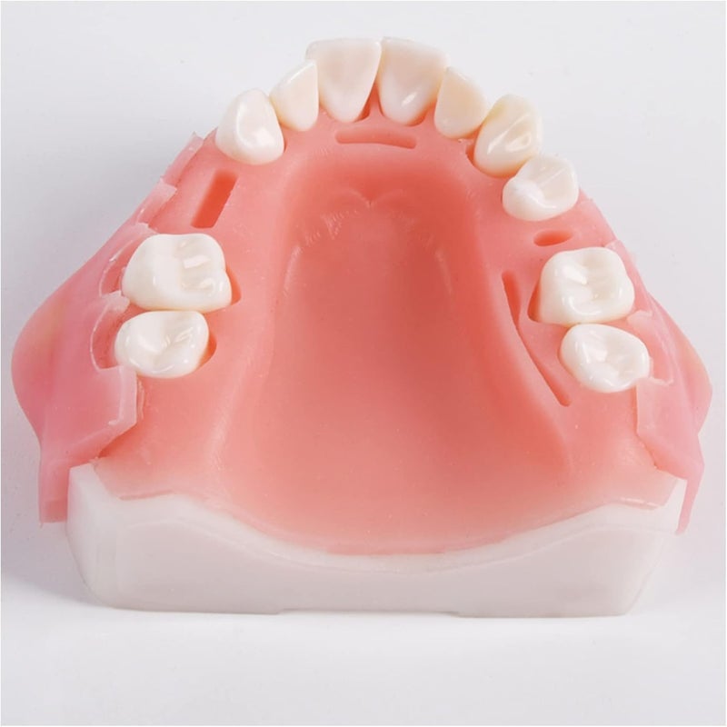 Teeth Implant Model, Lower Jaw Teeth Model, Simulated Oral Tooth for Oral Cavity Demonstration Explaination Or Dental Teeth Study Teaching Model,B - Image 3