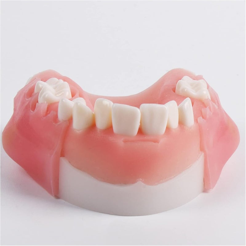 Teeth Implant Model, Lower Jaw Teeth Model, Simulated Oral Tooth for Oral Cavity Demonstration Explaination Or Dental Teeth Study Teaching Model,B - Image 2