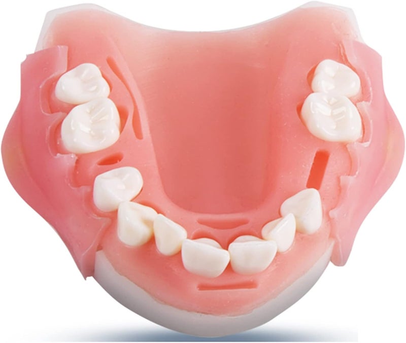 Teeth Implant Model, Lower Jaw Teeth Model, Simulated Oral Tooth for Oral Cavity Demonstration Explaination Or Dental Teeth Study Teaching Model,B - Image 1