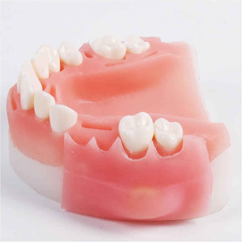 Teeth Implant Model, Lower Jaw Teeth Model, Simulated Oral Tooth for Oral Cavity Demonstration Explaination Or Dental Teeth Study Teaching Model,B - Image 4
