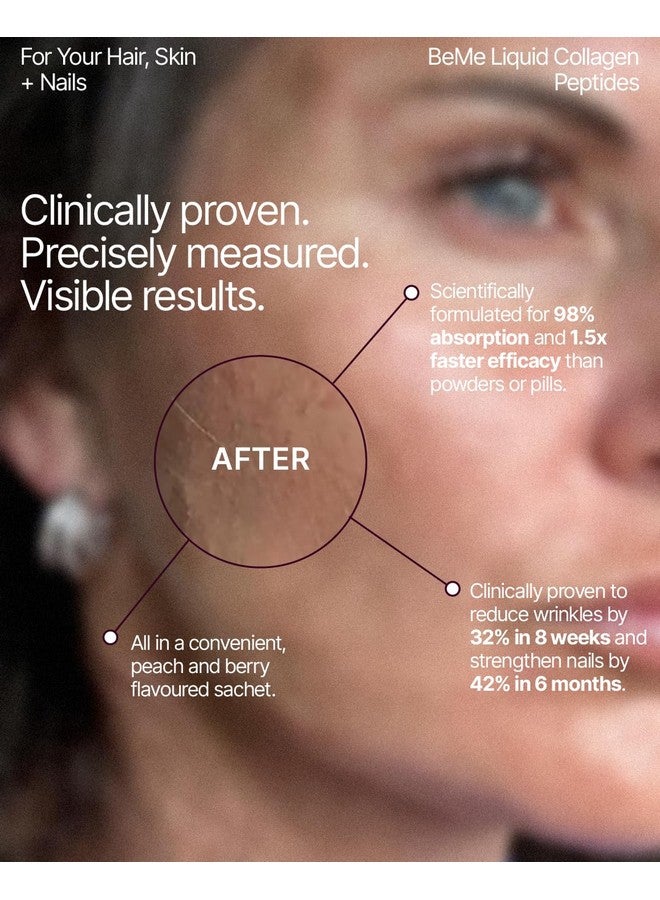 BeMe Liquid Collagen for Women - 2500mg Verisol hydrolyzed Marine Liquid Collagen - Clinically Tested Collagen Supplements - Quick Absorption, high bioavailability - Supports Skin, Hair & Nails - Image 4
