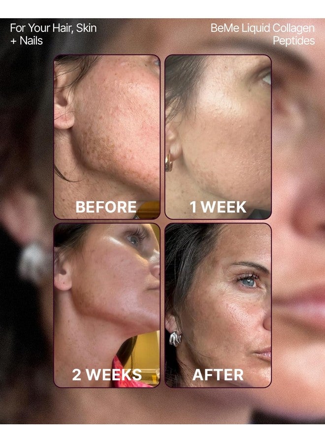 BeMe Liquid Collagen for Women - 2500mg Verisol hydrolyzed Marine Liquid Collagen - Clinically Tested Collagen Supplements - Quick Absorption, high bioavailability - Supports Skin, Hair & Nails - Image 3