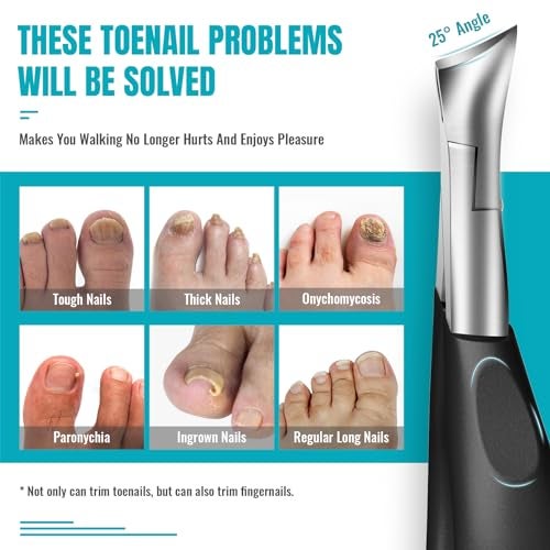 RONAVO Toe Nail Clippers for Thick Nails - RONAVO Nail Clippers.Heavy Duty Professional Thick & Ingrown Toenail Clippers,Wide Jaw & Easy-Grip Long Handle,Ideal for Elderly/Diabetics/Men (Black) - Image 3