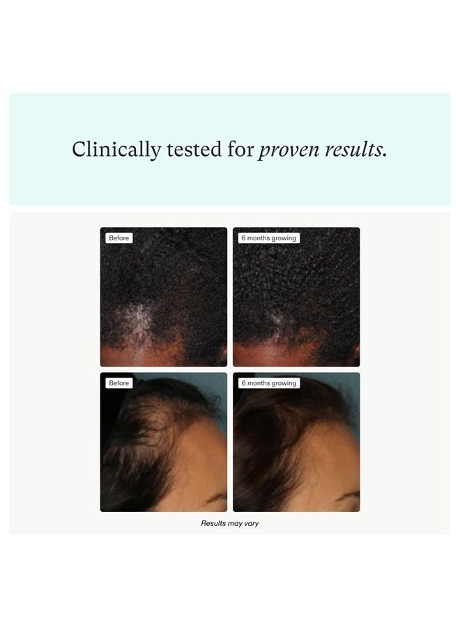 NUTRAFOL Women's Hair Growth Supplements, Ages 18-44, Clinically Proven Hair Supplement for Visibly Thicker and Stronger Hair, Dermatologist Recommended - 1 month supply, 1 Refill Pouch - Image 3