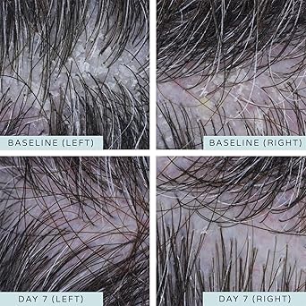 Ameliorate Deep Cleansing Hair and Scalp Mask 225ml Lab6 Shea butter Dermatologically tested Trichologist Approved - Image 4