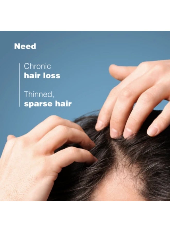 Ducray Anaphase Anti-Hair Loss & Anti-Thinning Shampoo 200ml - Image 2