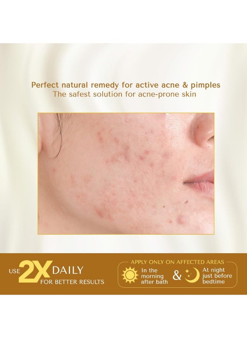 Barva Skin Therapie Turmeric Acne Spot Cream 10ml for Acne Scars and Skin Inflammation - Image 3