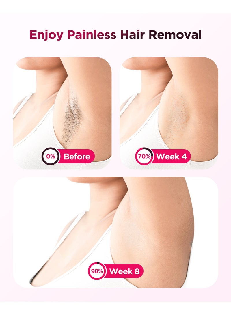 JOOYEE Laser Hair Removal with Ice Cooling Painless IPL hair removal device Armpits Legs Arms Bikini Line Treament Home Use - Image 3