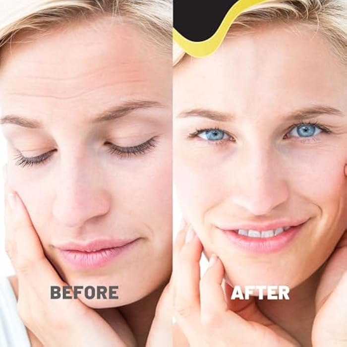 TOLEVITA Forehead Wrinkle Patches | Forehead Lines Remover | Anti-Wrinkle Patches for Smoothing Fine Lines with Hydrogel, Aloe Extract, Collagen, Vitamin E, For All Skin Types - 12 Pcs - Image 5