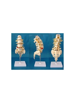 Generic Medical Human Spine Spine Pathology Demonstration Model Anatomical Model Lumbar Vertebrae Sacrum & Coccyx, with Herniation Disc Sold by 
