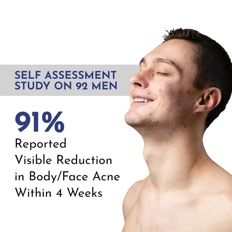 Mannlich AntiAcne Soap  Controls Excess Sebum  Handmade Body  Face Soap for AcneProne and Oily Skin  2 Salicylic Acid 2 Niacinamide  2 Tea Tree Oil  Brightens Skin Fades Dark Spots  Prevents Body Acne  pH Balanced SLS Free Dermatologically Tested  75 g Pack of 2 - Image 5