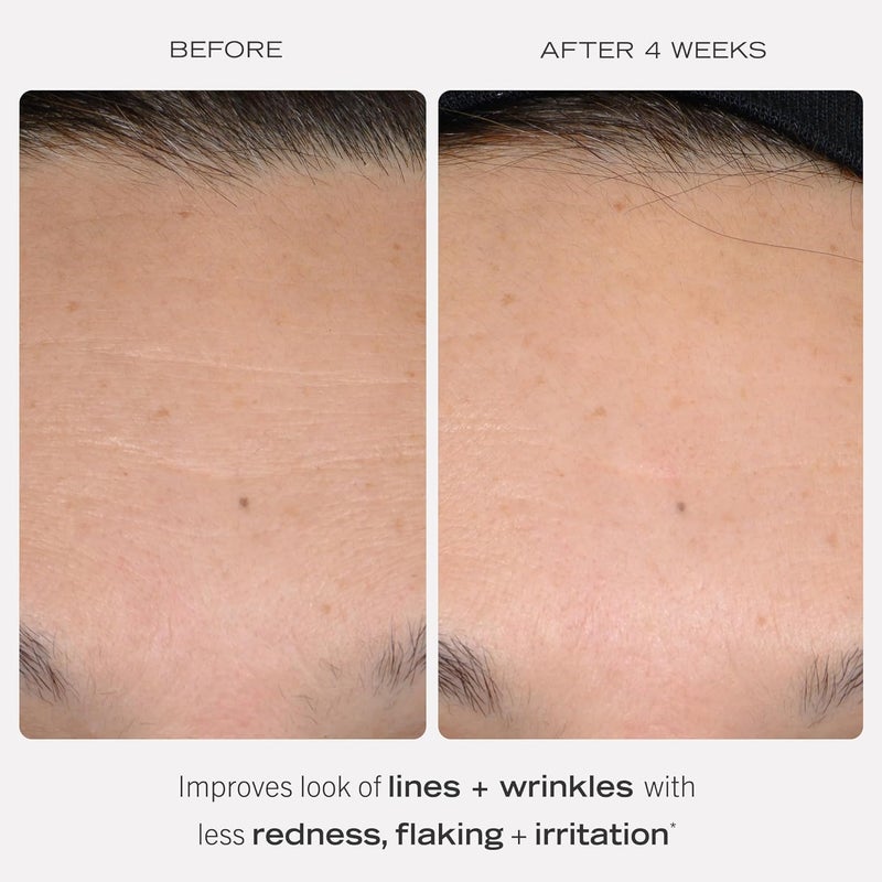 First Aid Beauty - 0.3% Retinol Complex Serum with Peptides, Designed for Sensitive Skin, Helps Visibly Improve Lines and Wrinkles with Less Irritation than Traditional Retinol, Non-Comedogenic, 1 oz - Image 3