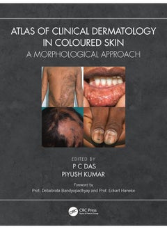 Atlas of Clinical Dermatology in Coloured Skin: A Morphological Approach 