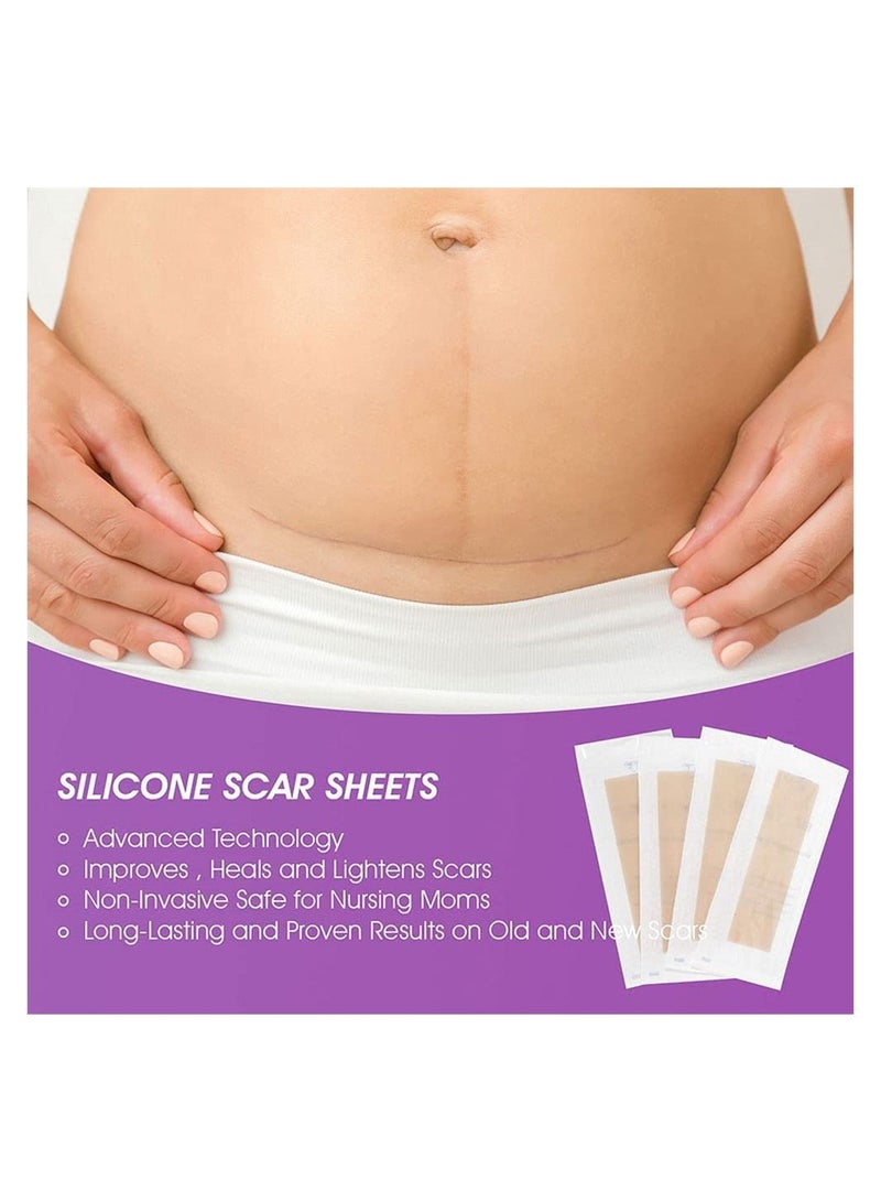 SYOSI Silicone Scar Sheets, Strips, Tape, Keloid, C-Section, Surgical-Scars Removal Treatment for Women and Men, Soften Flattens Burns Remover Reusable Sheet Resulting Fast (Pack of 4 Pcs) - Image 2