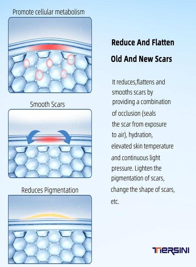 TIERSINI Silicone Scar Sheet, Silicone Scar Tape for Surgery (1.6” x120” Roll-300CM), Silicone Scar Strips, Keloid Treatment, C-Sections, Surgical Scars, C-Section Scars - Image 3