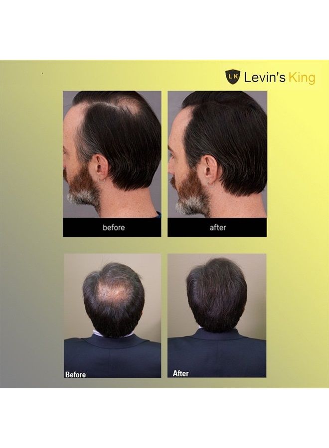 Levins King Hair Building Fiber , Hair concealer Refill Pack Use All hair fiber Black Color 25 Gram Pack of 1 - Image 4