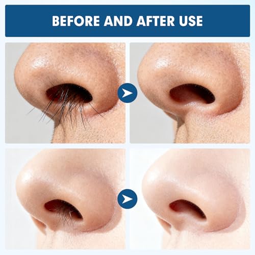 CNTVO 10 Pcs Nasal Hair Cutter, 2-in-1 Double Sided Nose Hair Trimmer, 360° Rotating Manual Nose Hair Trimmer for Men and Women, Portable Professional Nasal Remover for Home Travel Essentials - Image 4