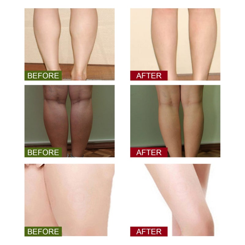 EELHOE 10Pcs Leg Slimming Foot Bath Bags Mild Herbal Formula Increase Blood Circulation Stimulate Detoxification Reduce Leg Edema - Image 2