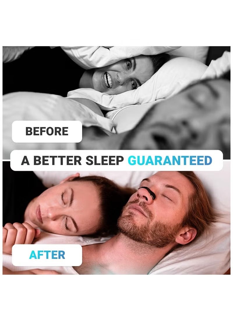 Intake Breathing - Nasal Strip Starter Kit (15 Count Black) - Boost Oxygen Intake, Reduce Snoring, Improve Sleep Quality - Sweat Resistant, Skin Safe Nasal Strips - Extra Strength Snoring Solution - Image 1