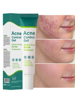 Acne Control Gel, Clears Acne, Acne Treatment Cream,Acne Spot Treatment gel,Clear Acne Spot Treatment Gel,Pimple Cream for Acne Prone Skin Care,Salicylic Acid Acne Treatment Gel,Clear Breakouts 30g - pzsku/ZA8E1C5AB1A81E0871169Z/45/_/1732359201/1913af35-69ef-4ad9-9527-5ac69bcf9f4b