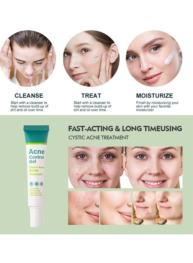 MOOYAM Acne Control Gel, Clears Acne, Acne Treatment Cream,Acne Spot Treatment gel,Clear Acne Spot Treatment Gel,Pimple Cream for Acne Prone Skin Care,Salicylic Acid Acne Treatment Gel,Clear Breakouts 30g  - Image 5