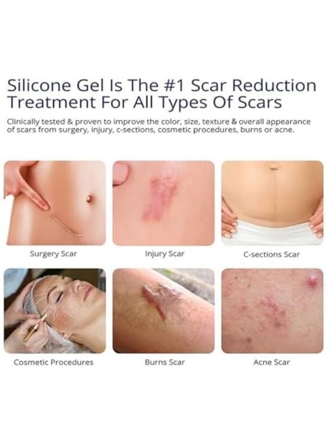 ASMOXA Silicone Scar Gel, Advanced Scar Cream for Surgical Scars, Burns, C-Section, Stretch Marks, Keloids, Fades Old & New Scars, Face & Body Scar Treatment, Smooths & Softens Skin, For Men & Women - Image 3