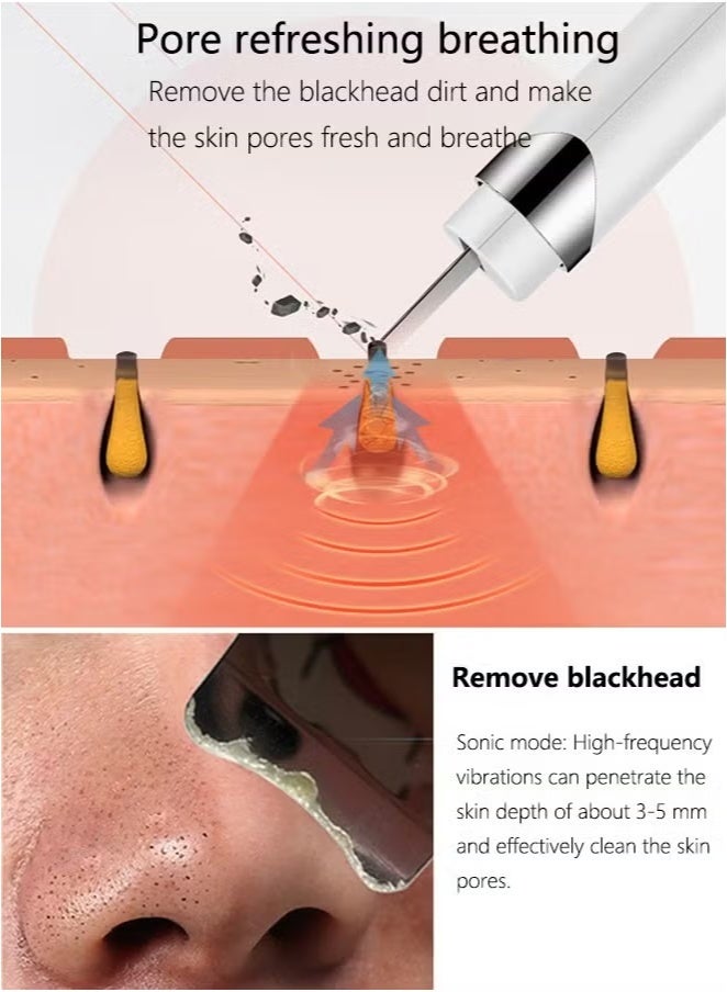 K.SKIN Skin Scrubber,Ultrasonic EMS Ion Exfoliating Device Face Cleanser and Blackhead Remover Pores Cleaning Wrinkle Remover Comedone Extractor Skin Care - Image 3