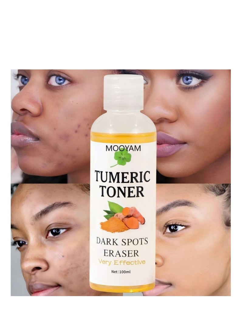 MOOYAM Turmeric Dark Spot Corrector Toner 100ML Facial Toner For Acne Prone Skin Dark Spot Remover For Face Hydrating Face Toner For Women Treatment  - Image 1